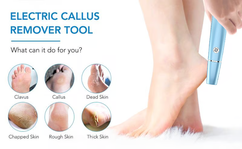🔥Hot Sale - 50% OFF🔥Electric Feet Callus Remover?