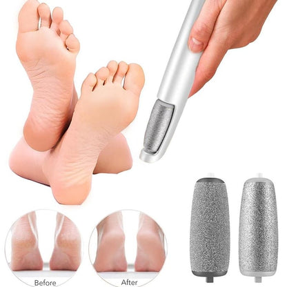 🔥Hot Sale - 50% OFF🔥Electric Feet Callus Remover?